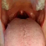 voreguys from patreon